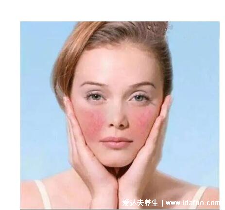 甲基丙二醇对皮肤的伤害，小心会对皮肤有害（可存在于化妆品中）