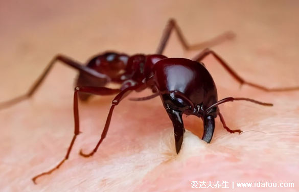 无敌的红火蚁图片，红火蚁咬人后症状图片(世界最危险的动物)