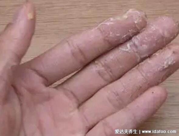 菠萝蜜怎么剥皮小窍门，简单3步快速剥皮有视频(附粘手洗掉的方法)