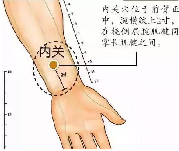 内关的准确位置图和作用，在手腕处看图就能找到(可缓解晕车)