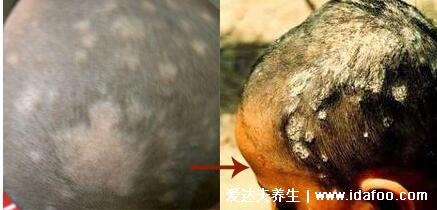 头皮癣症状图片早期图片，包括黄藓/白藓/黑藓三种类型(可多发儿童)