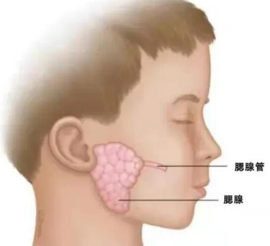 腮腺炎的症状图片，流行性腮腺炎会出现高热腮部肿胀(春冬高发)