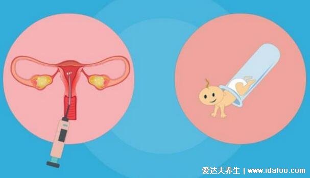 人工助孕方法有哪些，3种方法帮你顺利怀上小宝宝