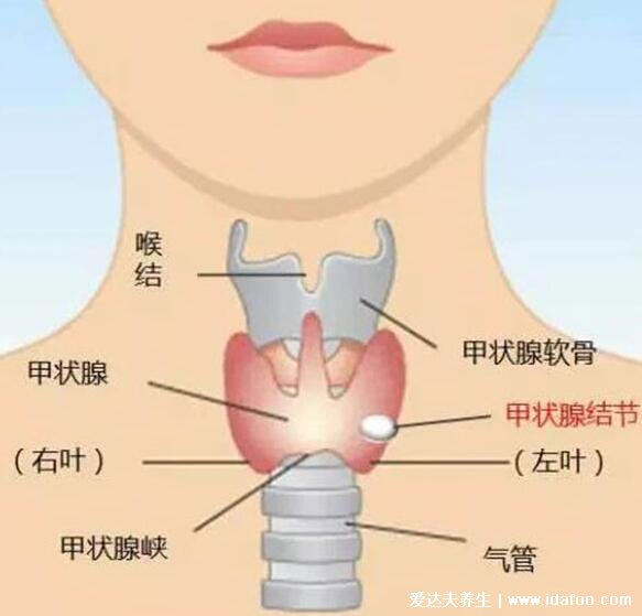 甲状腺位置图高清示意图，警惕脖子异常变粗有凸起肿块的情况