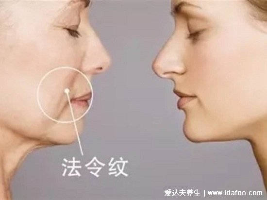 法令纹是哪里的皱纹图片，鼻翼两侧向下延伸到嘴角的两条线