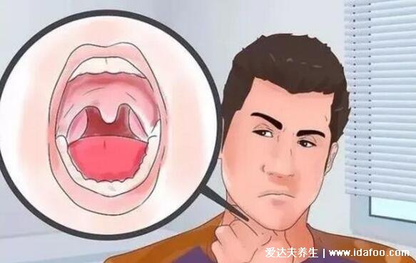嘴里发苦是什么原因造成的，多是精神性口苦需警惕肝胆疾病