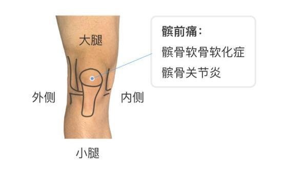 女性膝盖痛的可能问题，不同年龄段膝盖问题不同(年轻人半月板损伤)