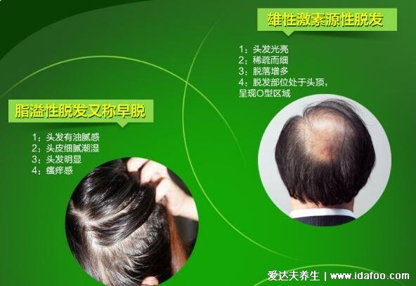 头发稀少怎么变浓密头发，中医理论宜早晚梳头(6个方法) 