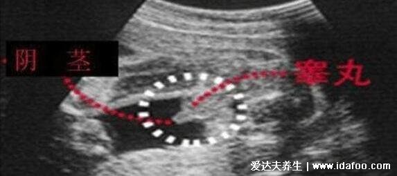 孕囊形状看男女(超准)，圆形是女宝。看6-7周的3个数据(长条是男/圆形是女)