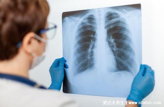 体检尽量别做肺部ct，建议肺癌高发人群做(5类人不适合)