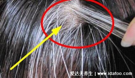 三个部位长白发最危险，后脑勺长白发注意补肾(前额/耳旁) 