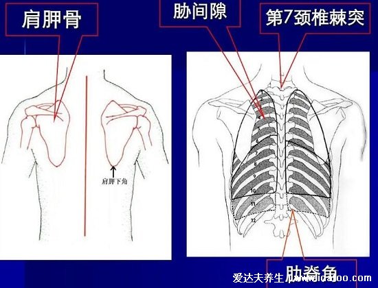 腎結石會引起身體哪個部位疼痛圖片，腹痛/腰痛(腎疼腰疼區別圖)