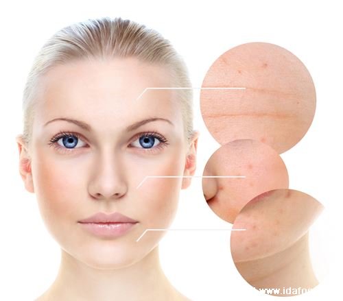 面部皮肤出现问题，一般情况下多与毛孔堵塞有关？