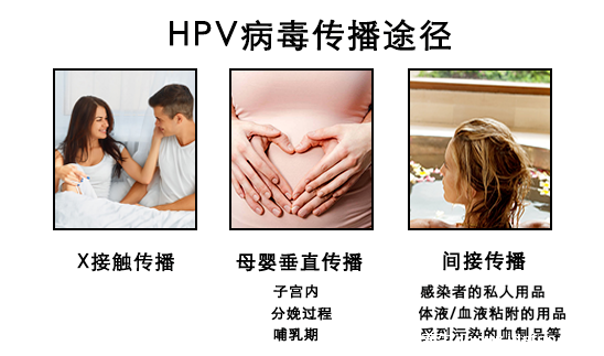 感染HPV病毒 就会恶变成宫颈癌吗？造成宫颈癌的真正原因究竟是什么？