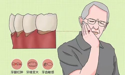 老年人牙齦萎縮常見原因不妨了解一下