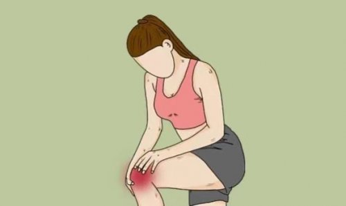  为什么中年女性容易膝盖疼
