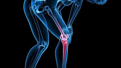 缓解膝骨关节疼痛的方法有哪些