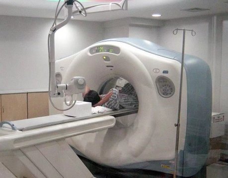 CT成像的方式有几种，做一次CT对人体的伤害有多大