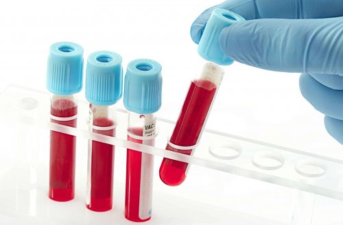 血常规检查3个指标异常需要注意