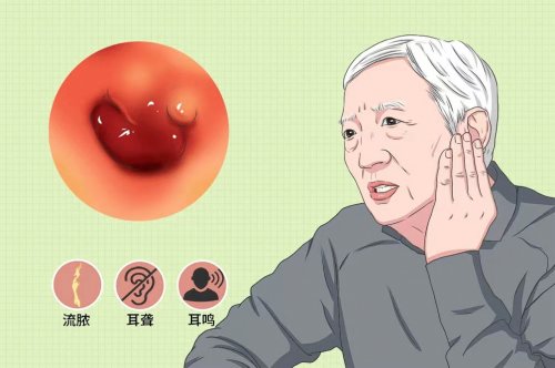 中耳炎症状有哪些表现，如何及早发现并治疗