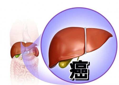 做好这3个检查提早知道肝脏是否有问题