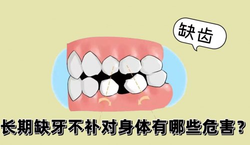 缺牙有害健康长期缺牙不补能给身体带来7大危害