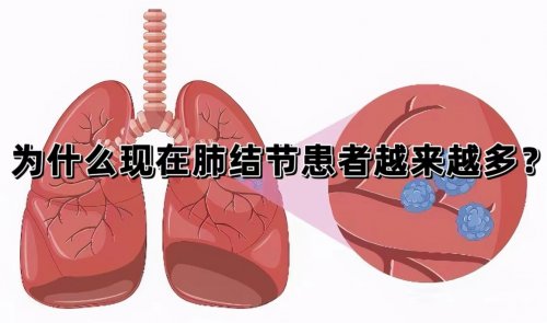 最近很多人都体检出肺结节是什么原因呢