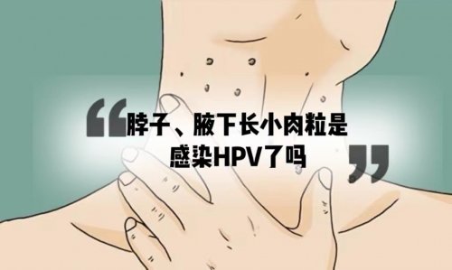 脖子腋下长小肉粒是感染HPV病毒了吗