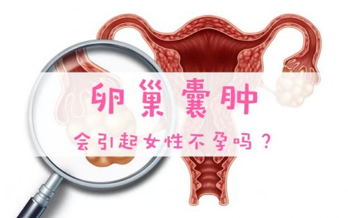 卵巢囊肿会引起女性不孕吗该如何治疗及预防